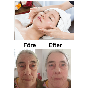 Japansk Ansiktslyftning